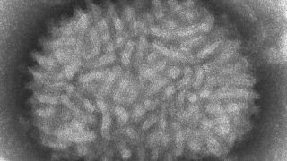Tumor Killer Viruses
