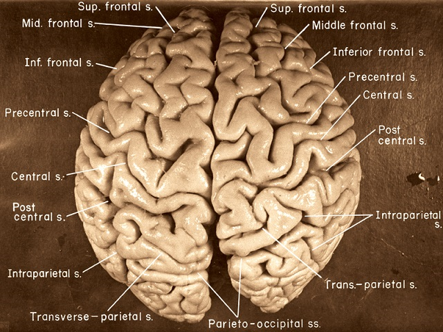 Einstein's brain
